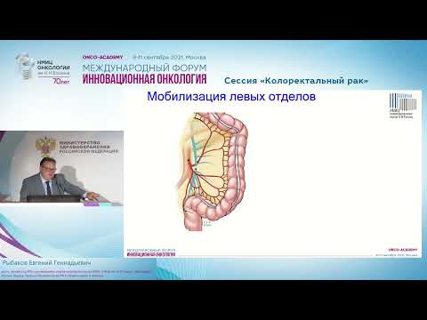 Видео: Факторы риска несостоятельности колоректального анастомоза и их влияния на тактику хирурга.