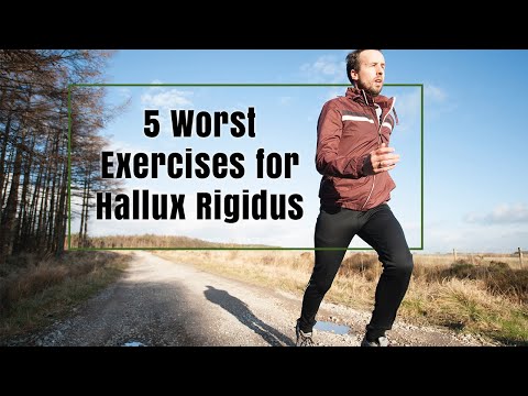 Видео: 5 худших упражнений при Hallux Rigidus