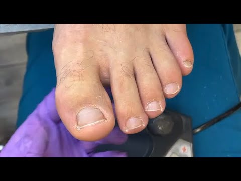 Видео: Мужской педикюр🦶🏻👀👌 • Поэтапно