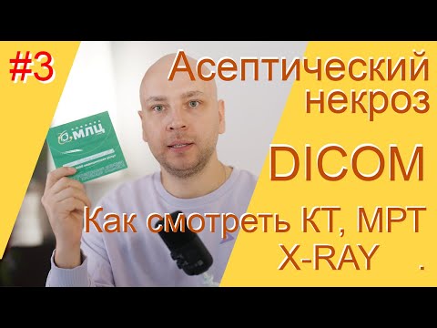 Видео: ч.3 | Асептический Некроз | Удобный способ хранить и делиться МРТ и КТ