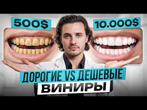 Видео: Композит или керамика — ЧТО ЛУЧШЕ? Какие виниры выбрать в 2025 году?