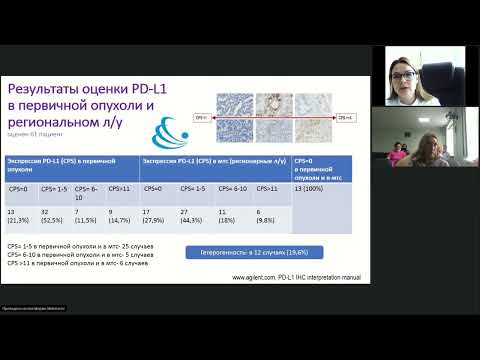 Видео: Опухоли ЖКТ (вебинар 3 апреля 2023)