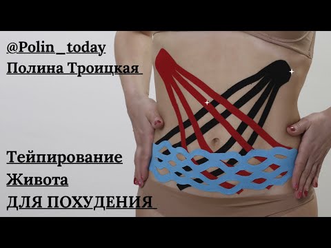 Видео: Тейпирование живота для похудения. Лимфодренаж и лифтинг живота.