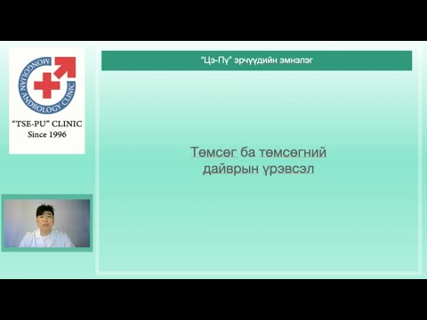 Видео: Төмсөг ба төмсөгний дайврын үрэвсэл