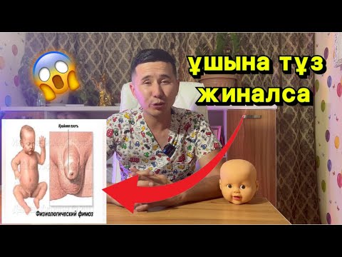 Видео: баланың әпшуіне жыныс мүшесіне тұз жиналса