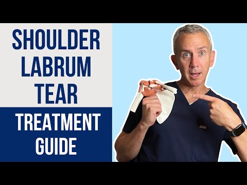 Видео: Лучшие решения при разрывах суставной губы плеча: от боли к выздоровлению