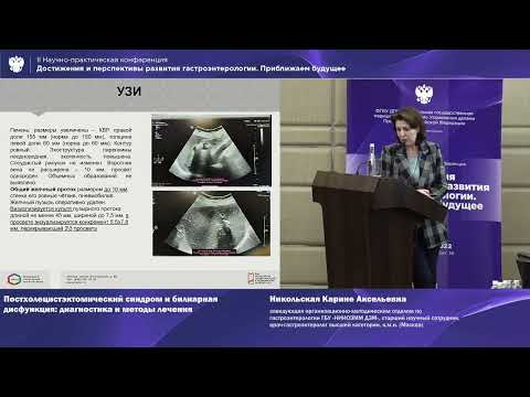 Видео: Никольская К.А. Постхолецистэктомический синдром и билиарная дисфункция: диагностика и методы лечен