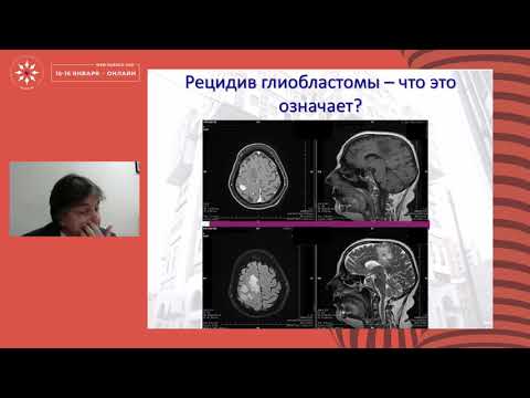 Видео: Исследования в онкологии 2020: Первичные опухоли головного мозга