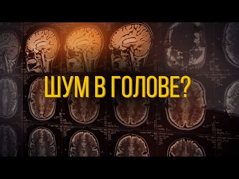 Видео: Первые симптомы ИНСУЛЬТА и что делать если он уже случился