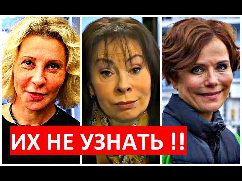 Видео: ЗВЁЗДЫ после НЕУДАЧНОЙ ПЛАСТИКИ!