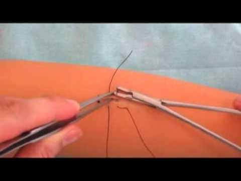 Видео: Техника наложения П-образного шва