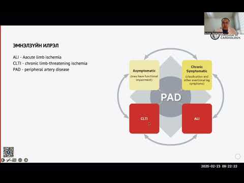 Видео: 2502. Захын артерийн судасны эмгэгийн удирдамжийн шалтгаан, эмгэгжамын хэсэг