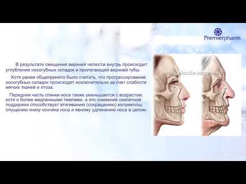 Видео: MesoSculpt C71. Безопасная коррекция комка Биша.  Гармоничные скулы без филлеров