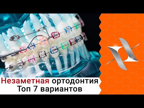 Видео: ТОП 7 способов выровнять зубы незаметно для окружающих