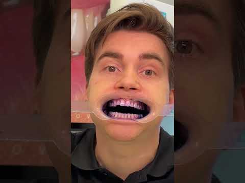 Видео: Давайте проверим, как эта щетка почистит мои испачканные зубы