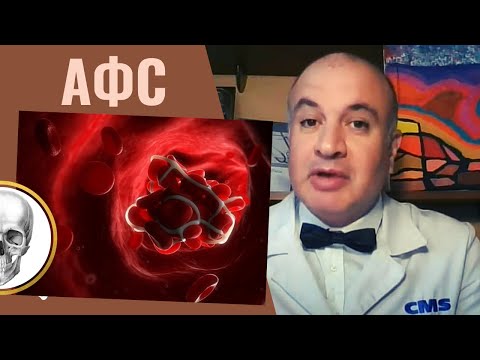 Видео: Антифосфолипидный синдром (АФС). Почему образуются антитела к фосфолипидам?