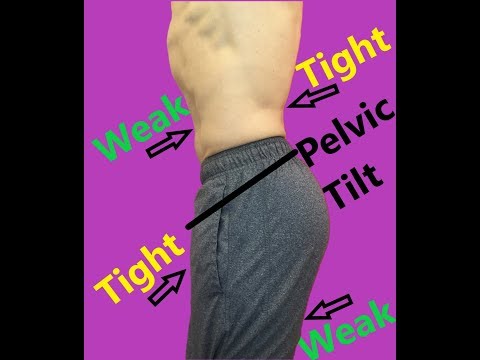 Видео: Упражнения для коррекции переднего наклона таза (исправьте неправильную осанку за 30 дней)
