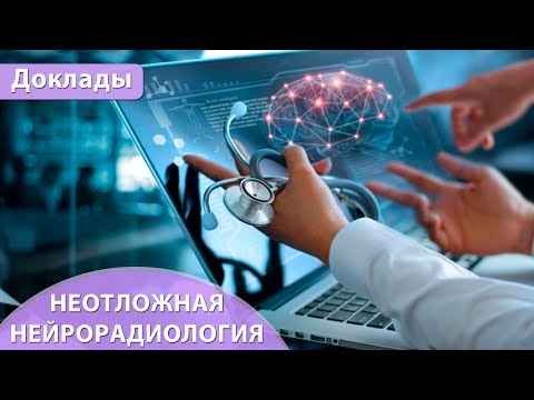 Видео: Неотложная нейрорадиология. Андрей Мангов