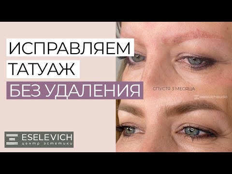 Видео: КАК ПЕРЕКРЫТЬ СТАРЫЙ ТАТУАЖ? В КАКИХ СЛУЧАЯХ МОЖНО ПЕРЕКРЫТЬ ТАТУАЖ?