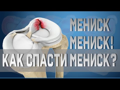 Видео: Разрывы, травмы, повреждения мениска. Резать или лечить? | Доктор Демченко