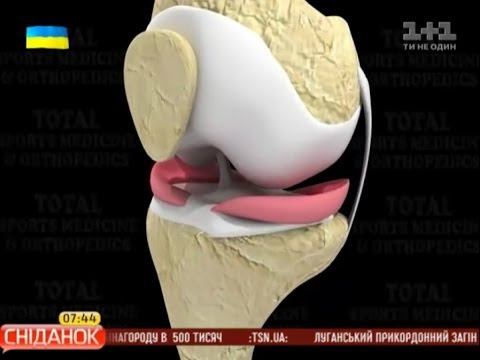 Видео: Причини та лікування травм меніска