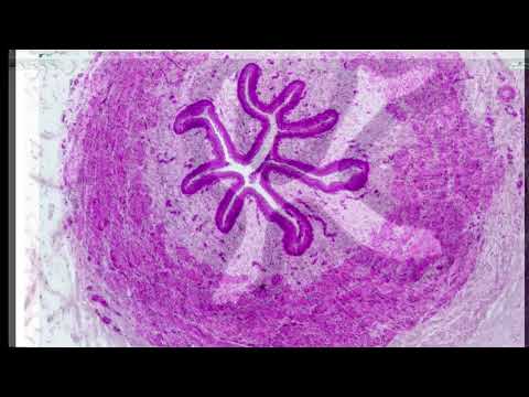 Видео: Препараты по теме Мочевыделительная система