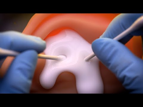 Видео: [ASMR] Глубоко и Глубоко!! Чистка ушей молочным маслом👂 (Микрофон погружен, Саб)