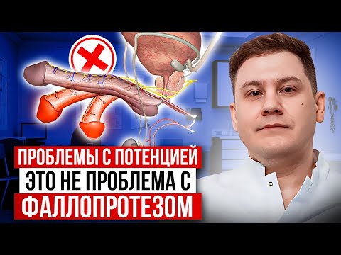 Видео: КАК РАБОТАЕТ ОДНОКОМПОНЕНТНЫЙ ФАЛЛОПРОТЕЗ