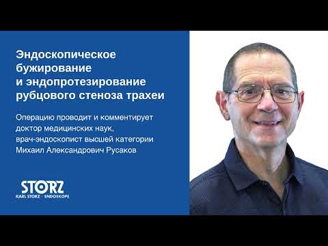 Видео: Эндоскопическое бужирование и эндопротезирование рубцового стеноза трахеи