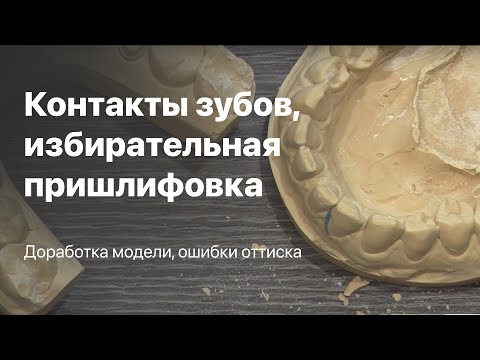 Видео: Контакты зубов, избирательная пришлифовка зубов, окклюзия и прикус. Доработка модели  ошибки оттиска