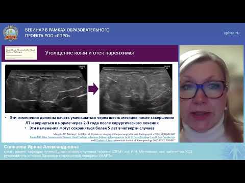 Видео: Вебинар "Лучевые изменения после комбинированного лечения рака молочной железы"