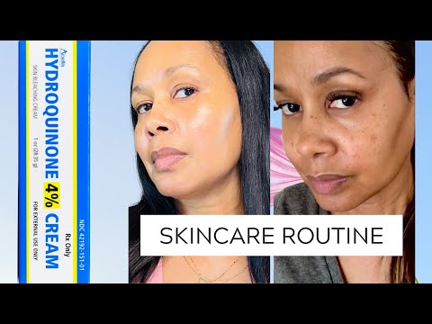 Видео: Крем с гидрохиноном до и после #гидрохинон #гиперпигментация #уходзакожей