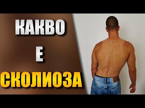 Видео: Какво е СКОЛИОЗА - Лекува ли се това гръбначно изкривяване?