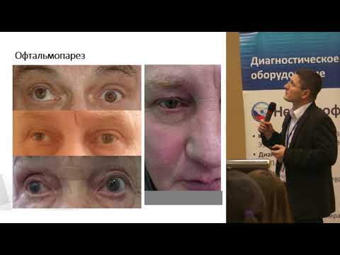 Видео: С.Н. Бардаков,  "ЭМГ одиночного мышечного волокна в диагностике глазной формы миастении"