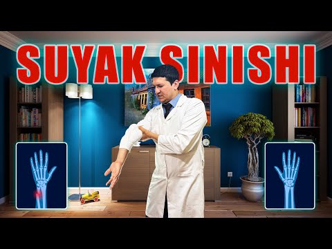 Видео: Suyak sinishi belgilari  (14 savol).Суяк синиши белгилари