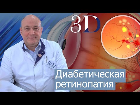 Видео: Диабет и зрение. Современное лечение диабетической ретинопатии.