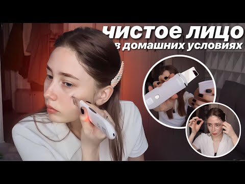 Видео: УЛЬТРАЗВУКОВАЯ ЧИСТКА ЛИЦА В ДОМАШНИХ УСЛОВИЯХ