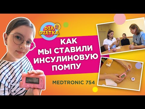 Видео: Установка инсулиновой помпы пошагово 🩺⚙️🩸