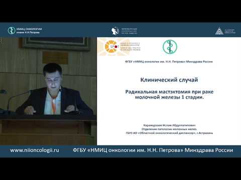 Видео: Радикальная мастэктомия при раке молочной железы I стадии. Разбор клинического случая