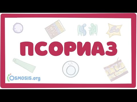 Видео: Псориаз (причины, симптомы, лечение) лекция дерматовенерология