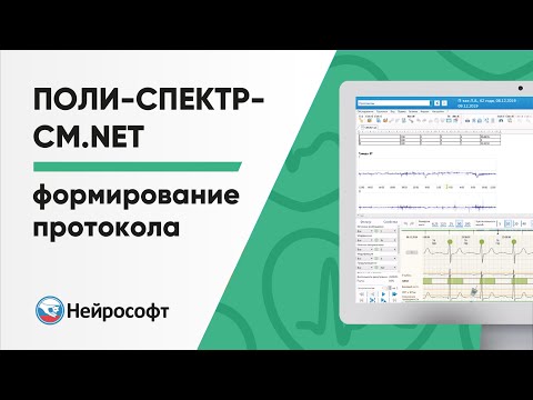 Видео: Формирование протокола холтеровского мониторирования в программе Поли-Спектр-СМ.NET