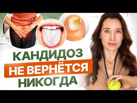 Видео: Как вылечить КАНДИДОЗ навсегда? ТЕСТ, симптомы, лечение, питание и лекарства при кандидозе