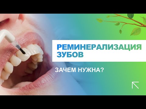 Видео: 💁 Для чего нужна реминерализация зубов?