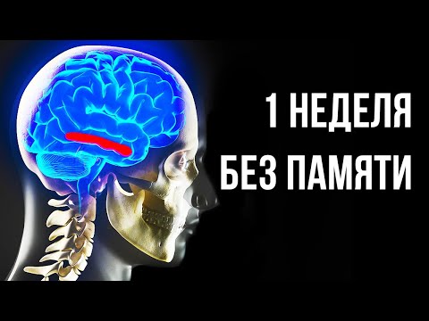 Видео: Что, если все 8 млрд человек вдруг потеряют память