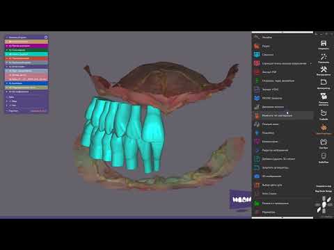 Видео: понедельничный exo-лайфхак №6 - горячие клавиши в #exocad