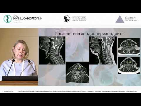 Видео: Трудные дыхательные пути. Взгляд МР-специалиста на проблему