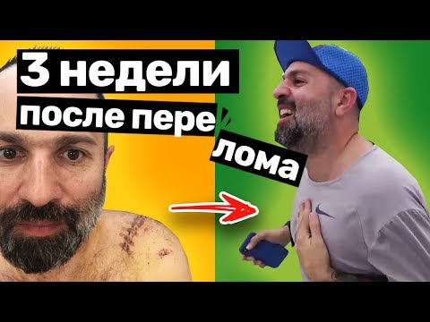 Видео: Восстановление после перелома ключицы: Таш снова бегает | Межпозвоночная грыжа