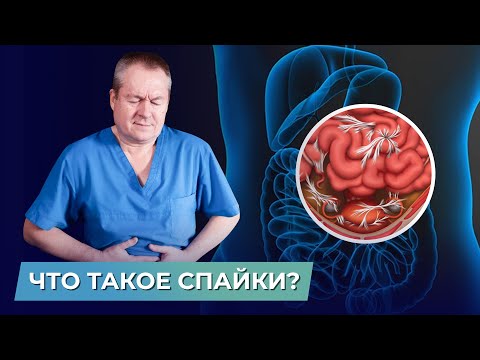Видео: Спайки в брюшной полости: как с помощью висцерального массажа убрать спаечную болезнь?