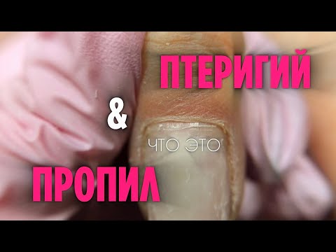 Видео: Перестаньте это спиливать! | Птеригий - это не пропил | Разбираем технику маникюра