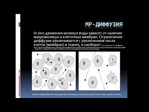 Видео: Доклад: «МР-диффузия в уточнённой диагностике рака мочевого пузыря».